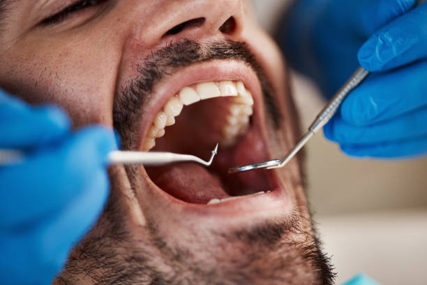 Best Walk-In Emergency Dental Services in Norwalk, CT